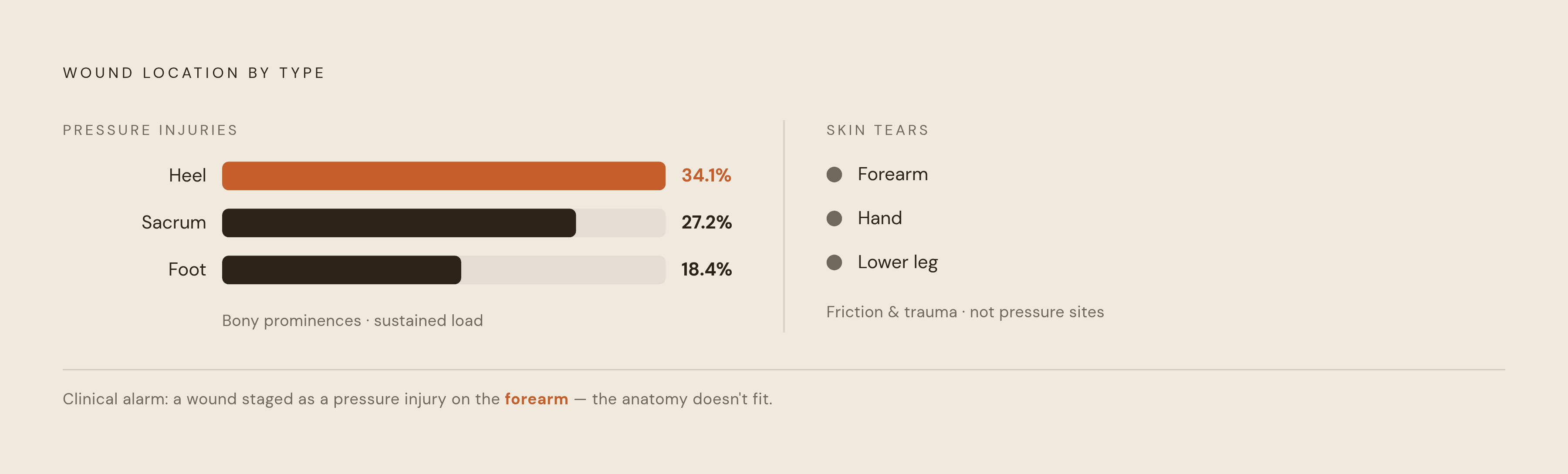 Diagram: Where Pressure Injuries Actually Appear vs. Where Skin Tears Do. Visualizes: Show a stark location contrast between the two wound types.