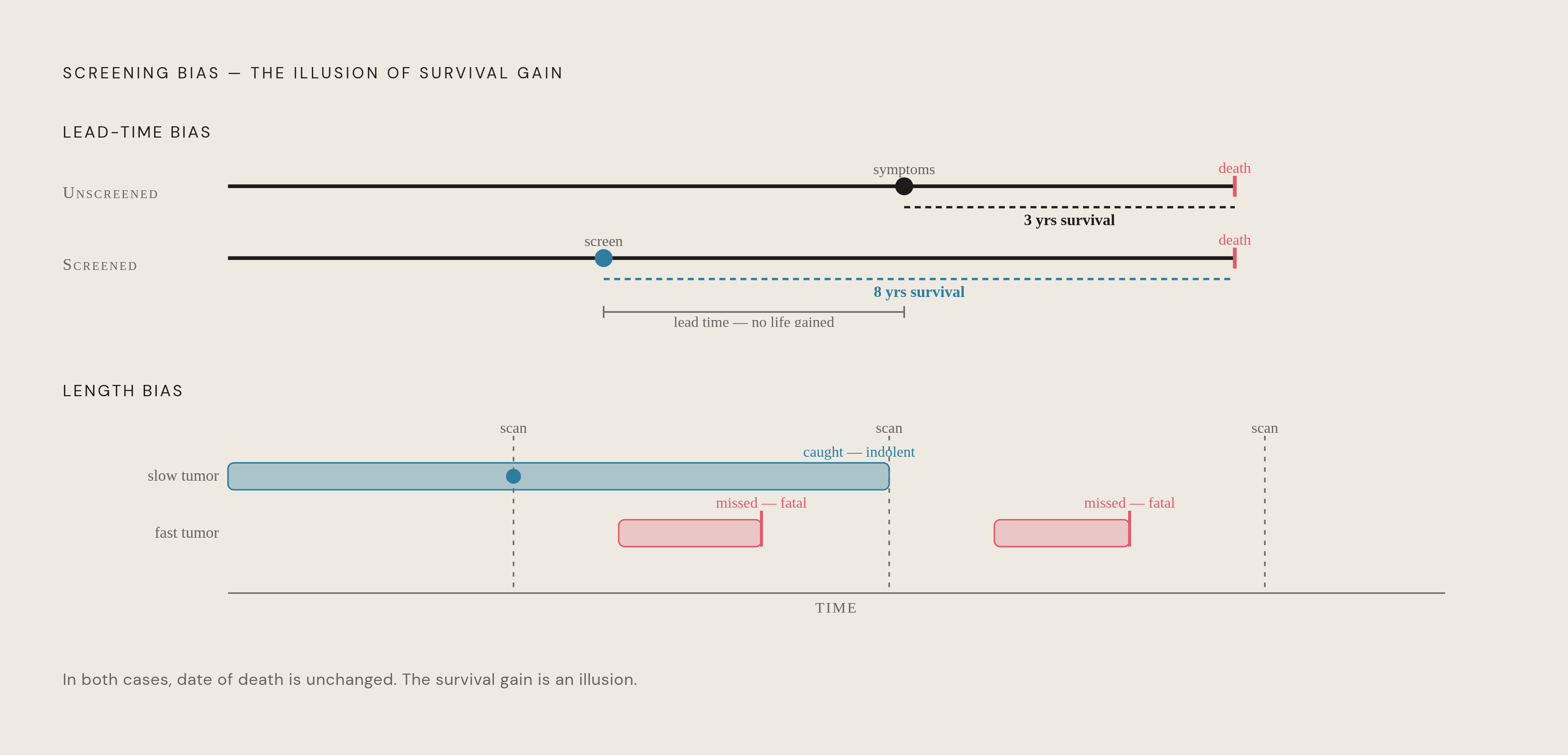 Diagram: Why Screening Looks Like a Win Even When It Isn't. Visualizes: Illustrate the two statistical distortions that make a screening program appear beneficial even when it does not extend lives.
