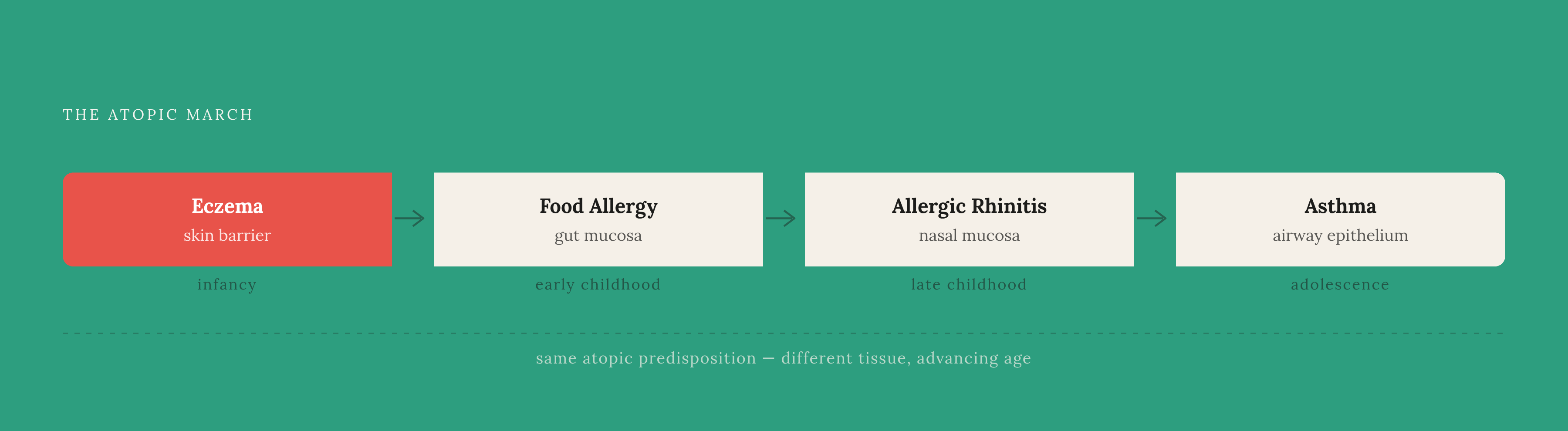 Diagram: The Atopic March: One Predisposition, Four Conditions. Visualizes: Show the atopic march as a left-to-right progression through four sequential stages: eczema (infancy) → food allergies → allergic rhinitis → asthma.