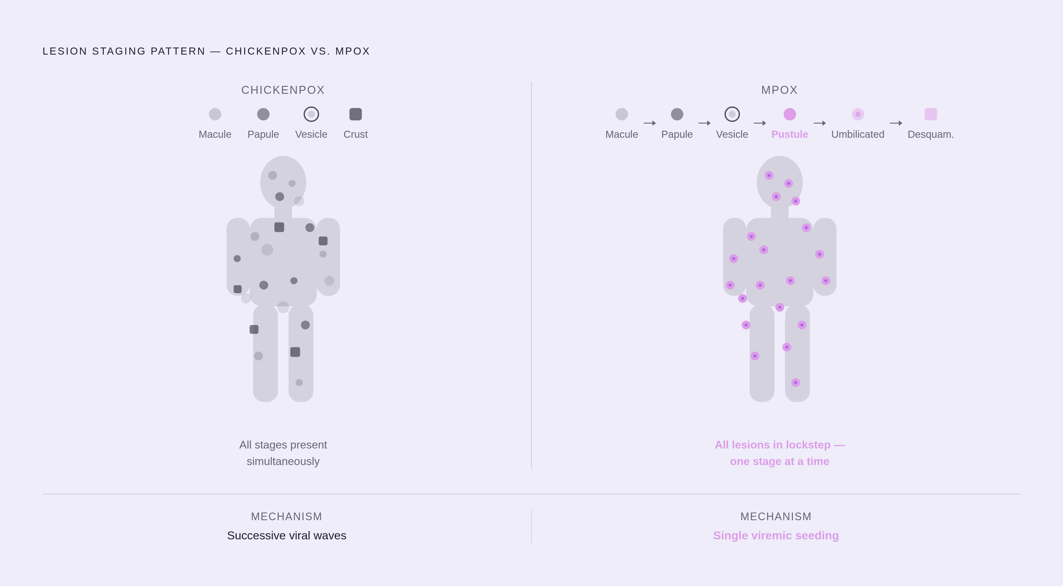 Diagram: Chickenpox vs. Mpox: Mixed Stages vs. Synchronized Progression. Visualizes: Visualize the fundamental contrast in how lesions evolve in chickenpox versus mpox.