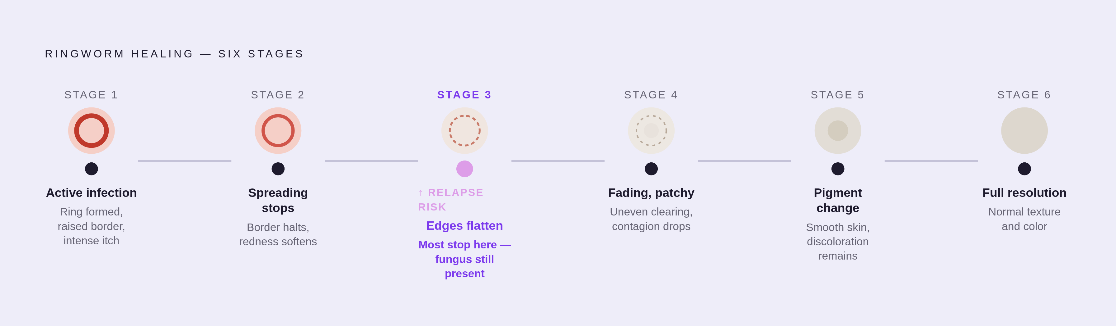 Diagram: Ringworm's Six Stages of Healing. Visualizes: Visualize a linear progression of six named healing stages for ringworm, showing what the skin looks like and the key marker at each point.