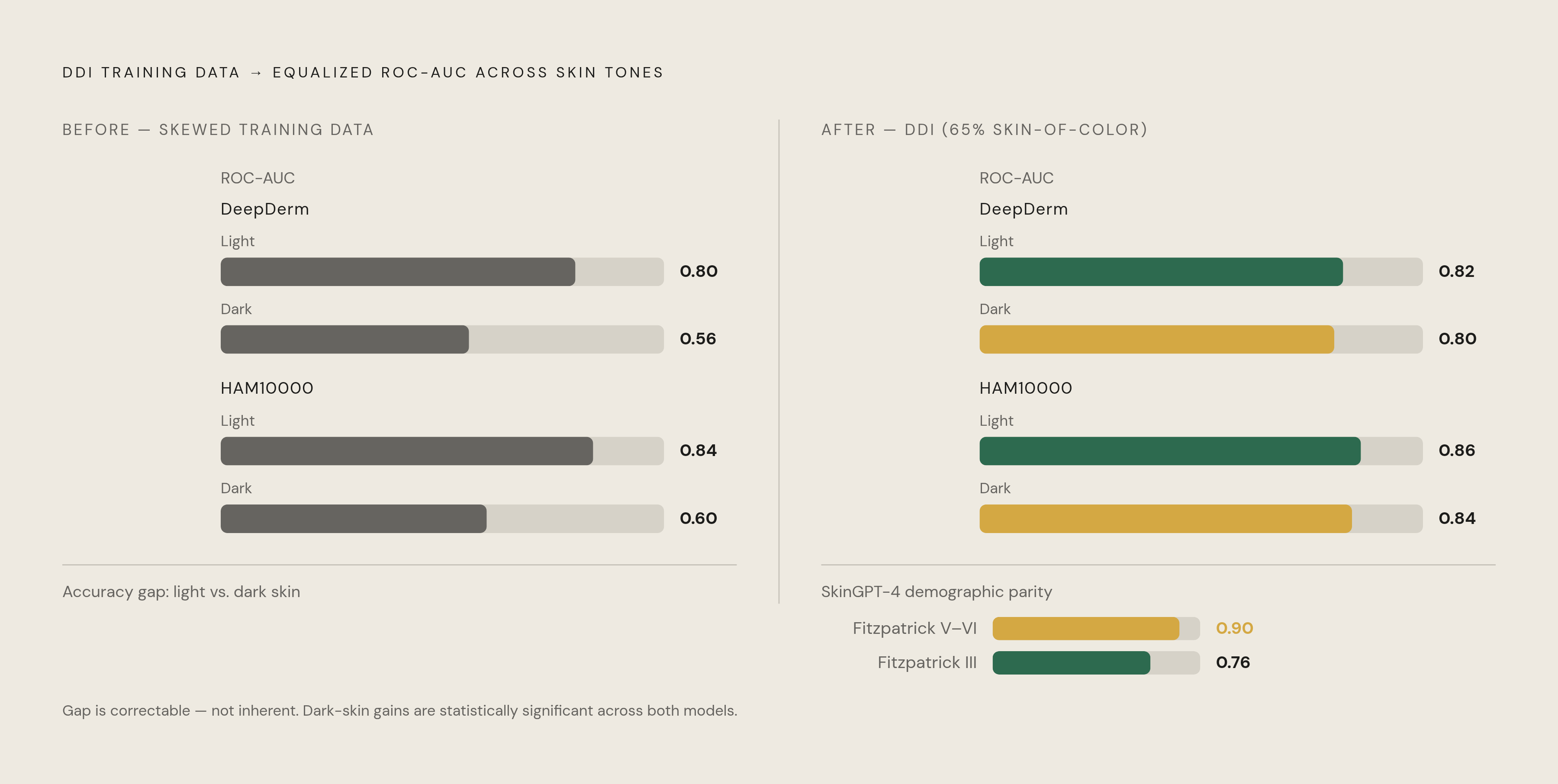 Diagram: Diverse Training Data Closes the Accuracy Gap. Visualizes: Show how incorporating the DDI dataset (65% skin-of-color images) into training changed model performance: for DeepDerm and HAM10000, ROC-AUC values between light and dark skin…