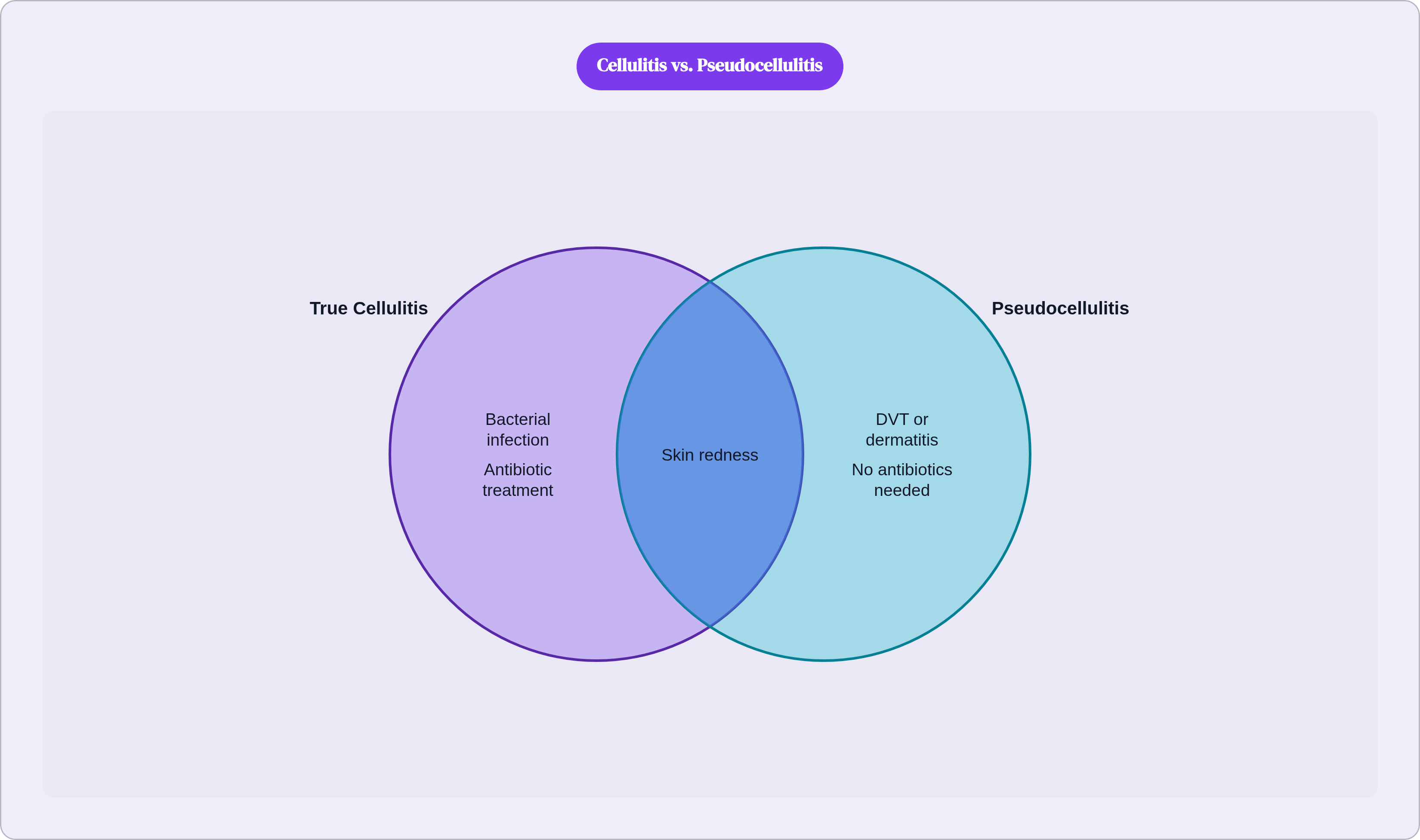 Venn diagram: Cellulitis vs. Pseudocellulitis. Compares True Cellulitis and Pseudocellulitis; overlap: Shared Features.