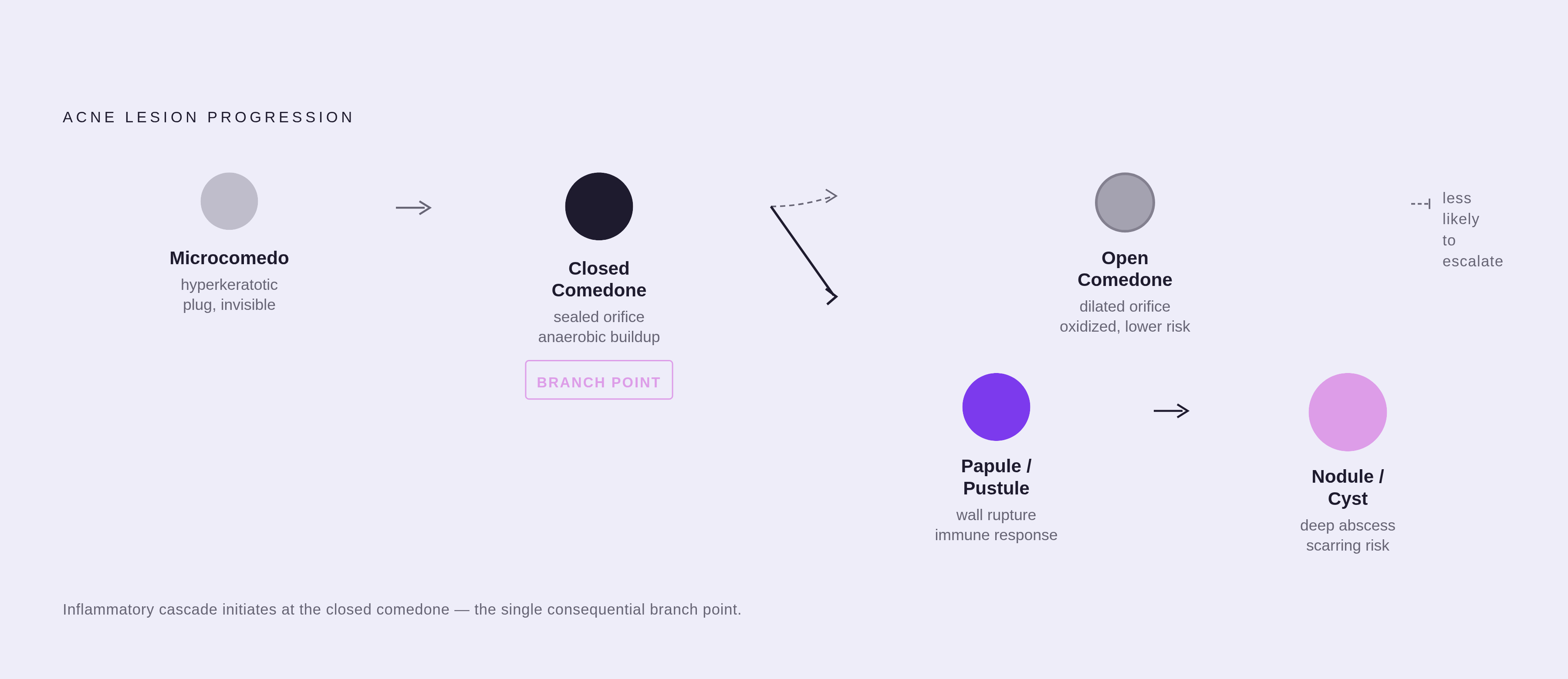Diagram: From Microcomedo to Cyst: The Five Lesion Stages. Visualizes: Show the sequential progression of a single acne lesion through five distinct stages, each representing a different biological mechanism: (1) Microcomedo — invisible…
