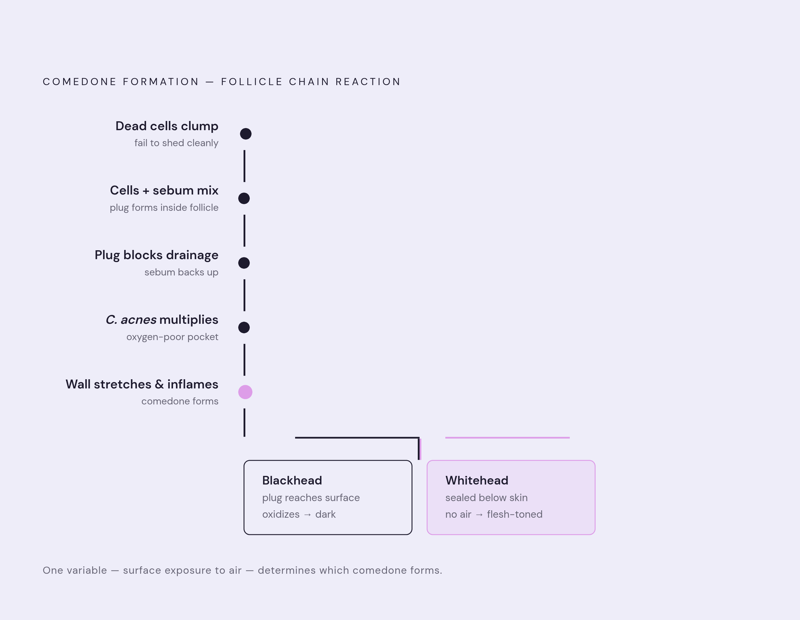 Diagram: How a Pore Gets Blocked: The Acne Formation Sequence. Visualizes: Illustrate the step-by-step chain reaction inside a follicle that produces a comedone, using exactly the sequence described in the article: (1) dead skin cells clump instead…