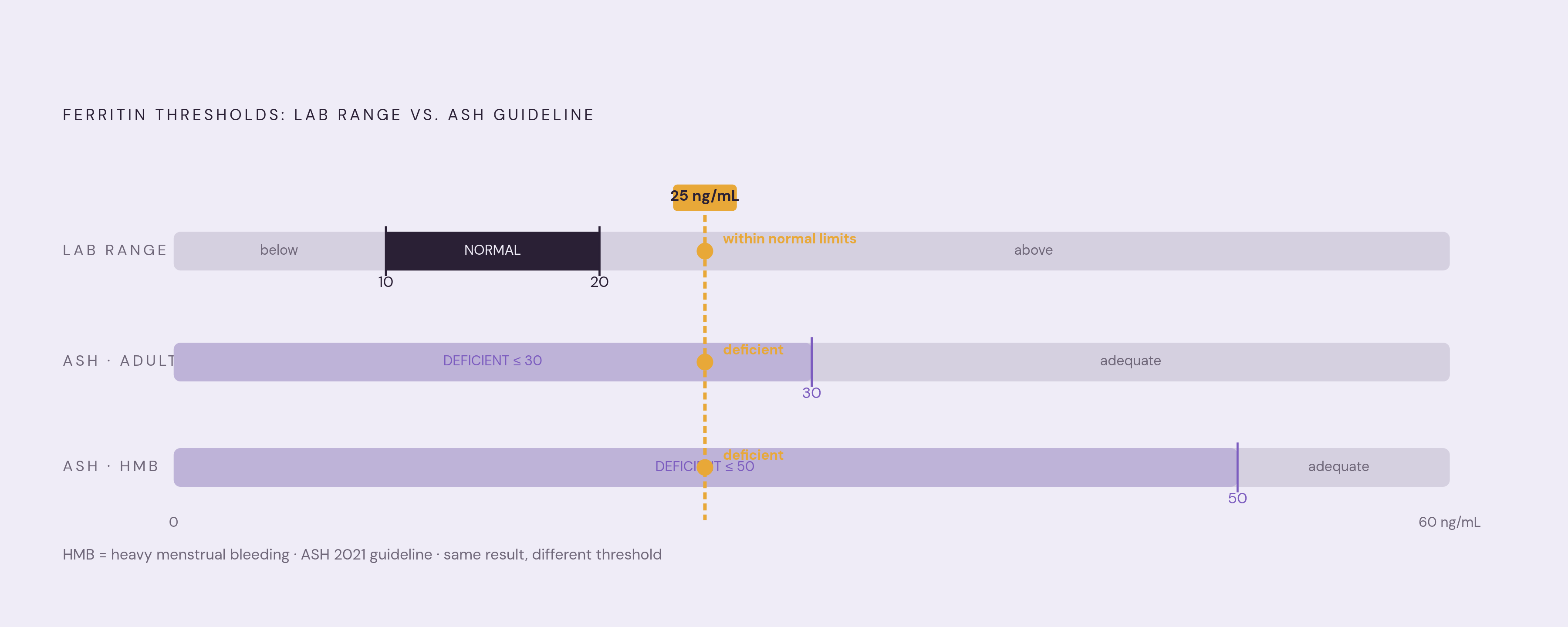 Diagram: Two Thresholds, One Number: How Ferritin Gets Misread. Visualizes: Visualize the gap between outdated lab reference ranges and the updated ASH guideline thresholds for ferritin.