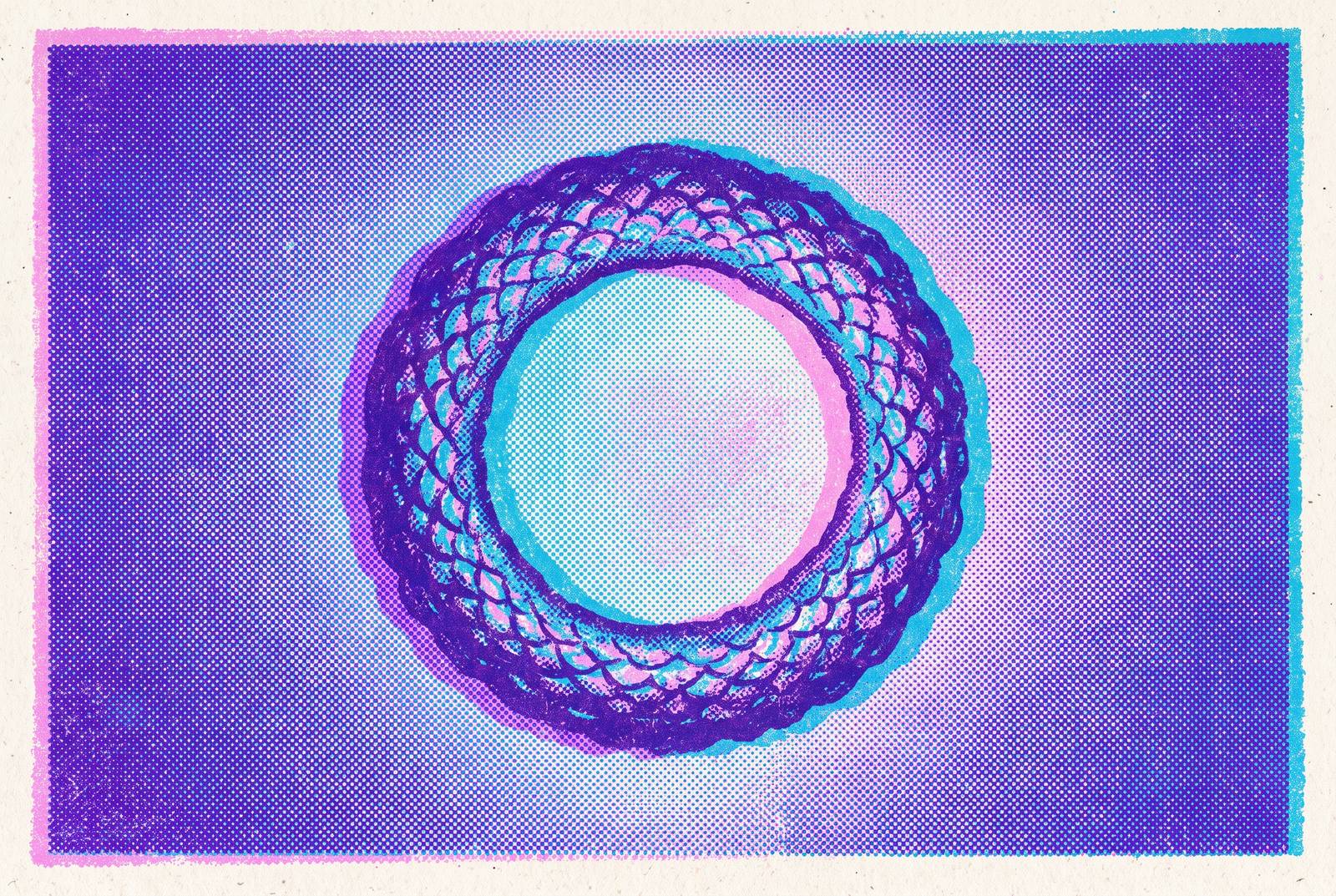 Cover illustration for “Ringworm Symptoms That Distinguish It From Other Ring-Shaped Rashes”
