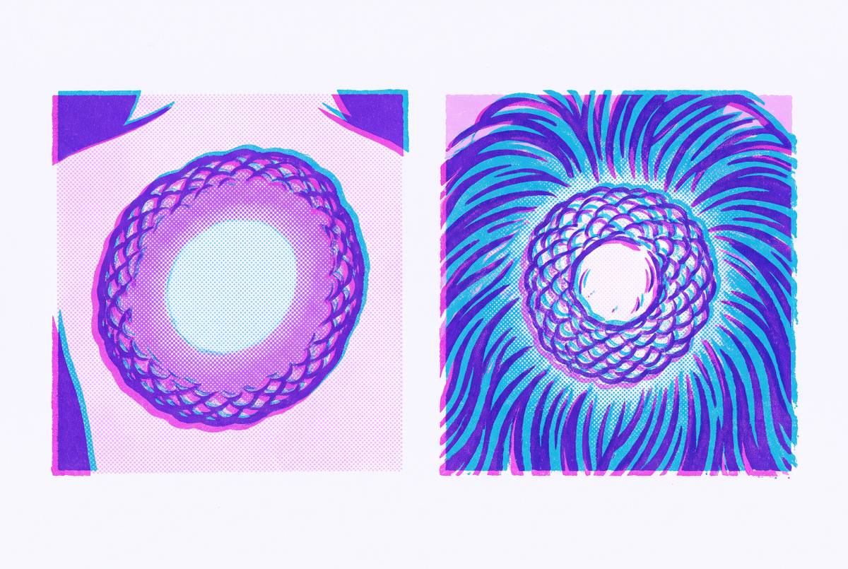 Cover illustration for “Ringworm on Skin Versus Scalp Visual Differences”