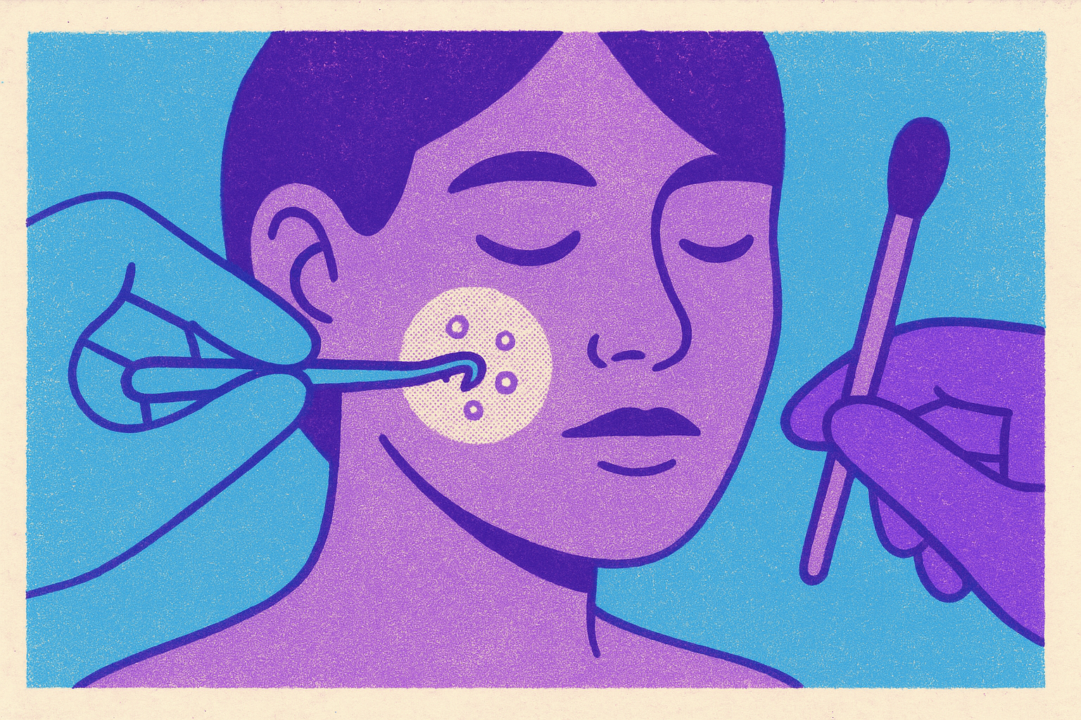 Cover illustration for “Milia Removal Methods and When Each Is Appropriate”