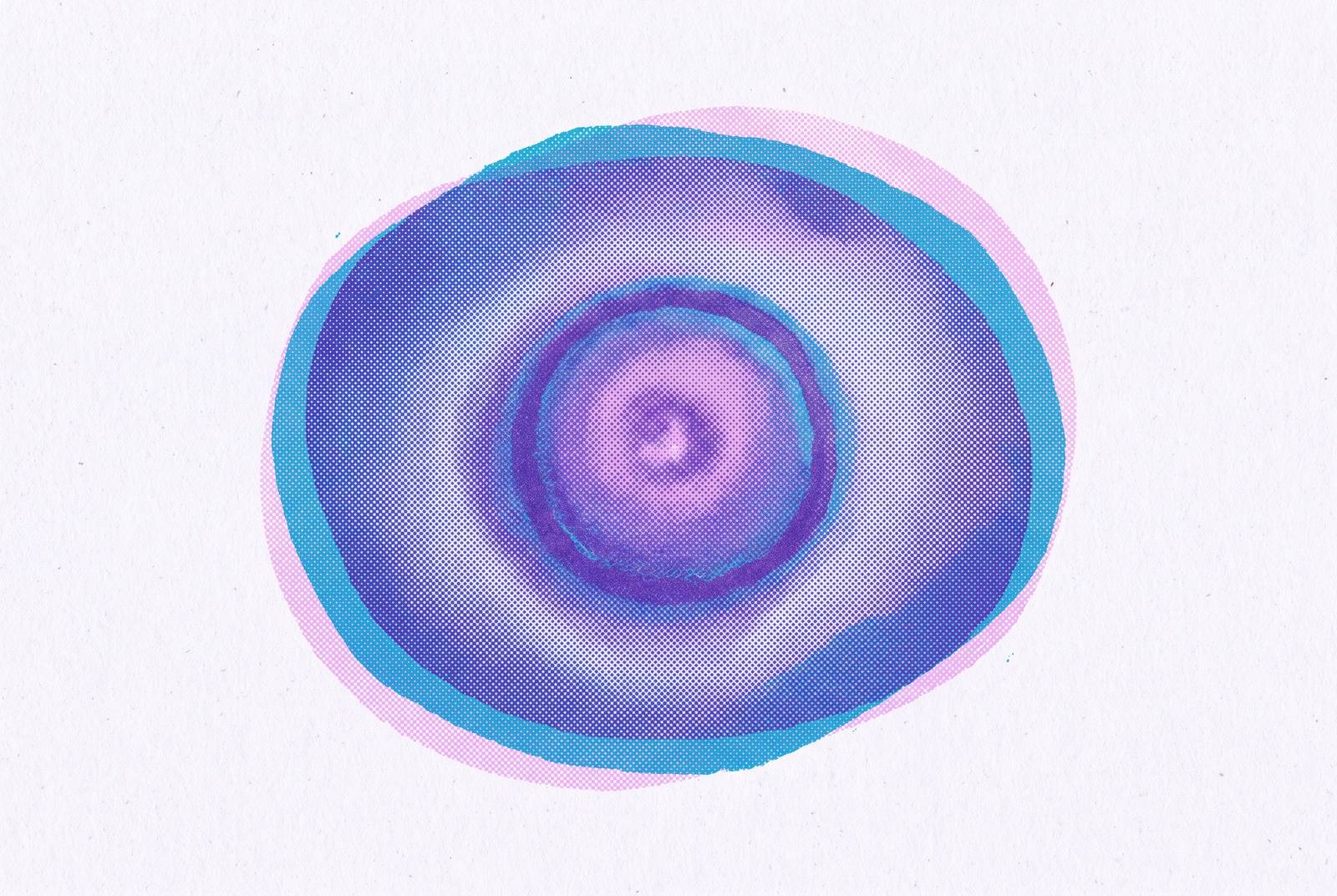 Cover illustration for “Dermatofibroma Appearance and Distinguishing Features”