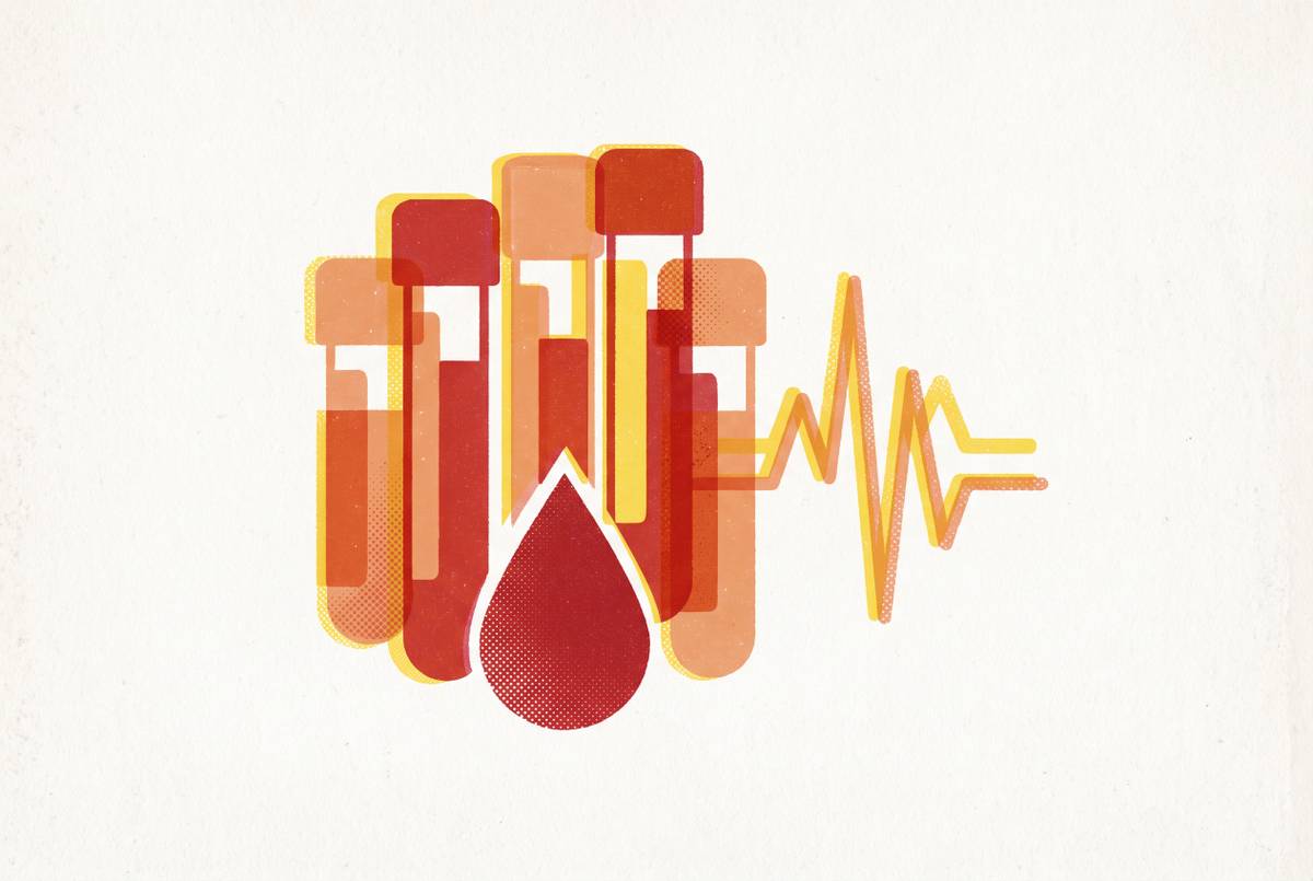 Cover illustration for “Comprehensive Metabolic Panel Results Explained”