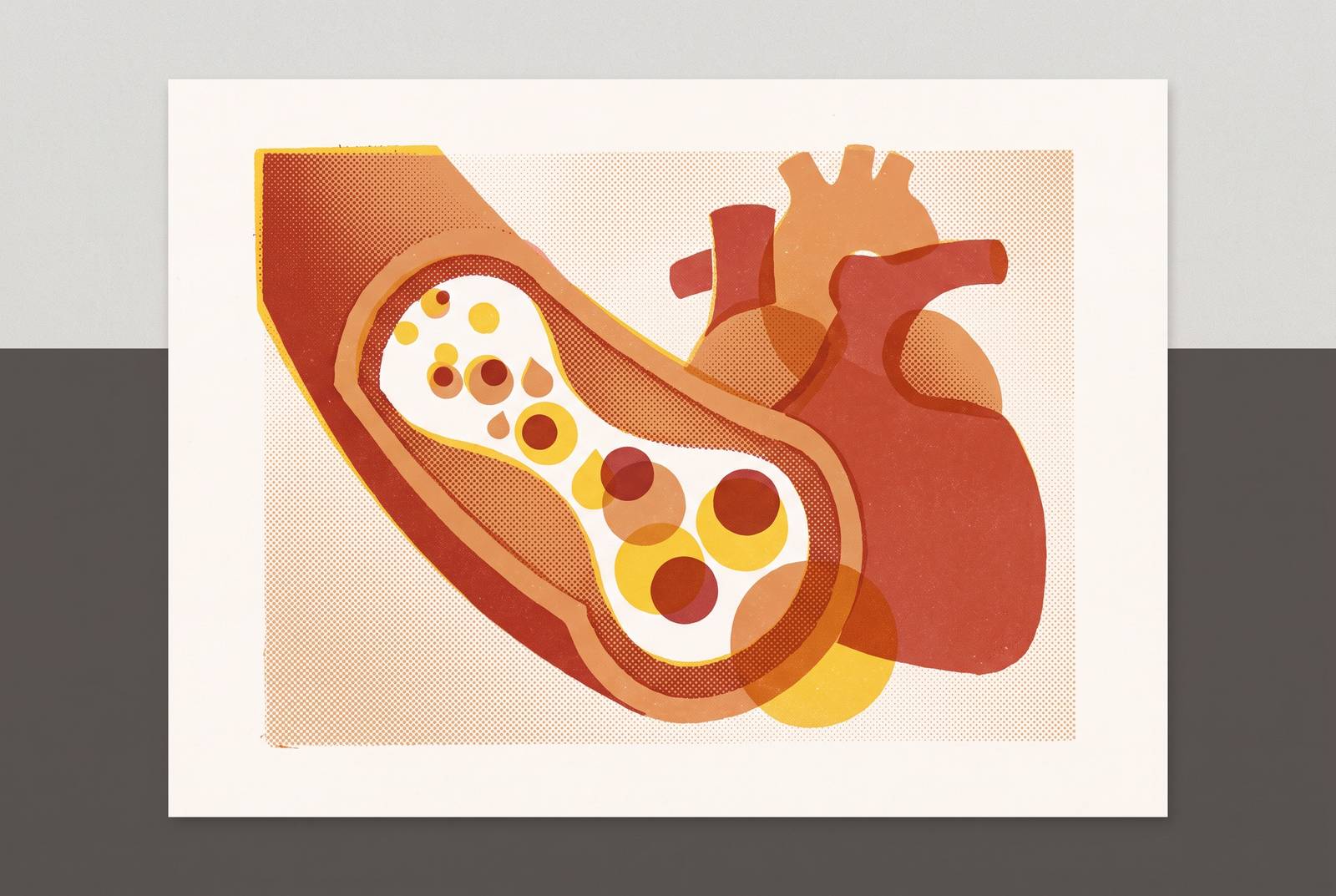 Cover illustration for “ApoB as a Cardiovascular Risk Marker Beyond LDL Cholesterol”