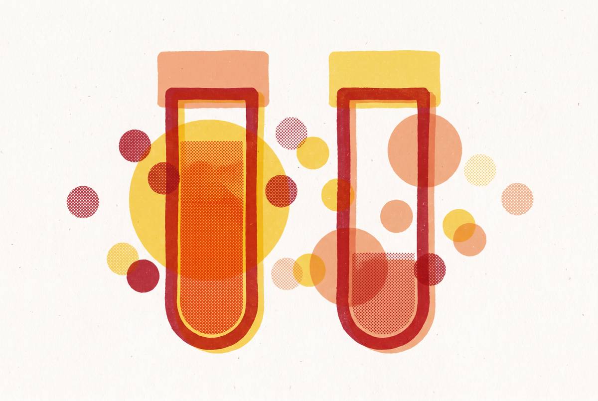 Cover illustration for “Vitamin B12 Deficiency in Serum Versus Active B12 Testing”