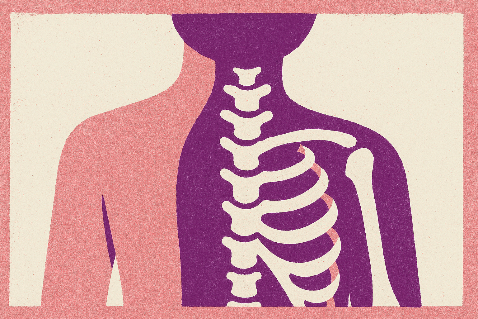 Cover illustration for “Why EDS Is Classified as a Rare Disease Despite Underdiagnosis”