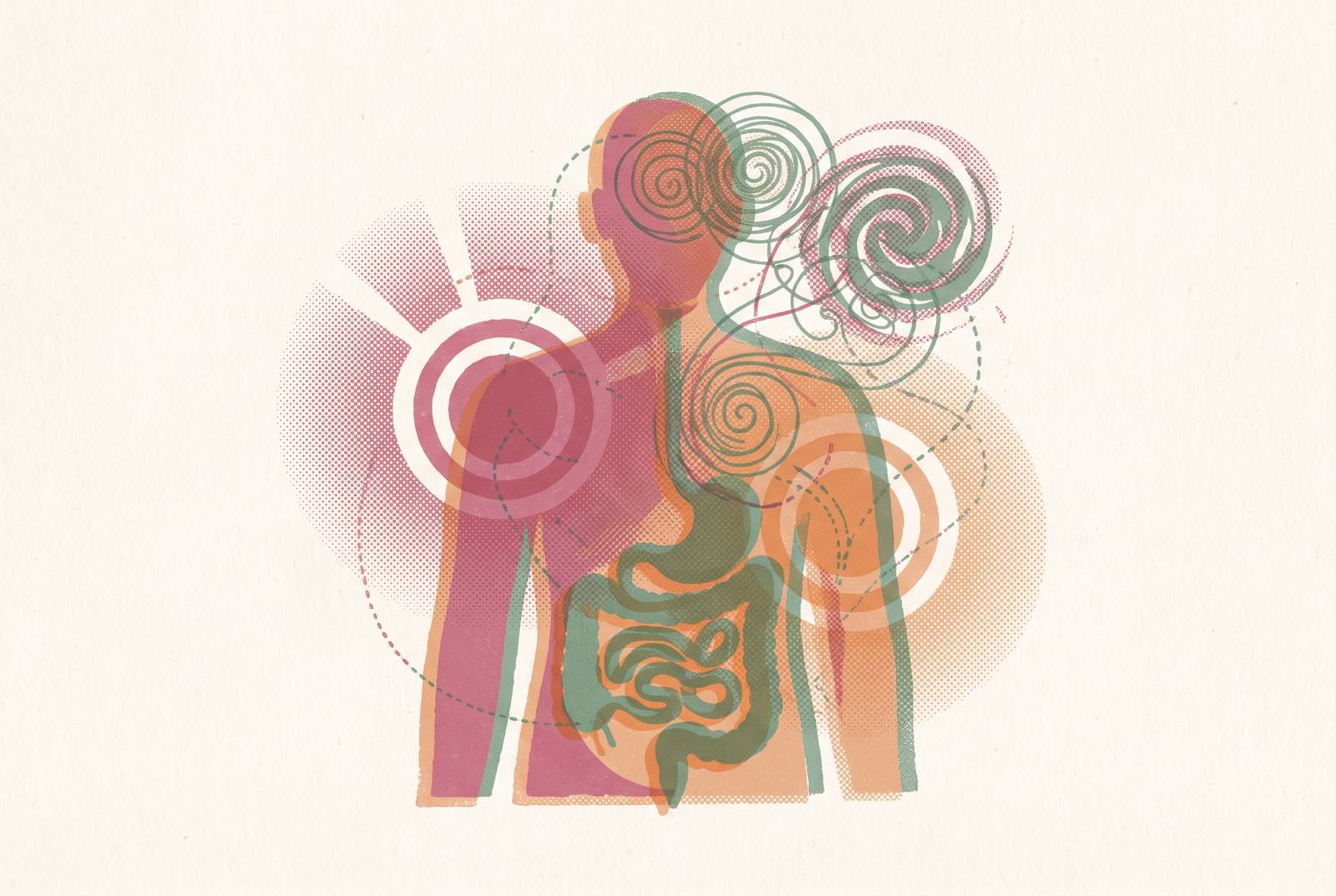 Cover illustration for “Tracking Fibromyalgia Alongside Comorbid Conditions Like IBS or Anxiety”