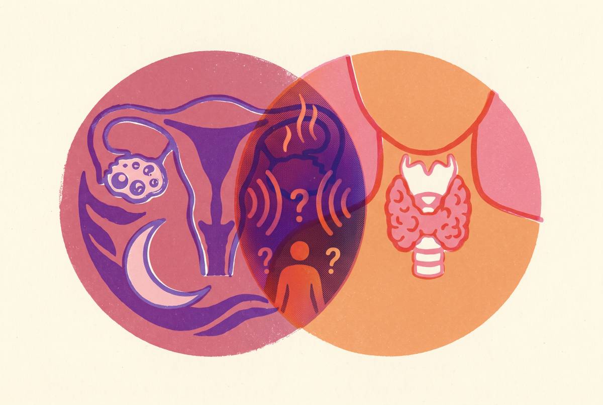 Cover illustration for “Perimenopause vs Thyroid Dysfunction Symptom Overlap”