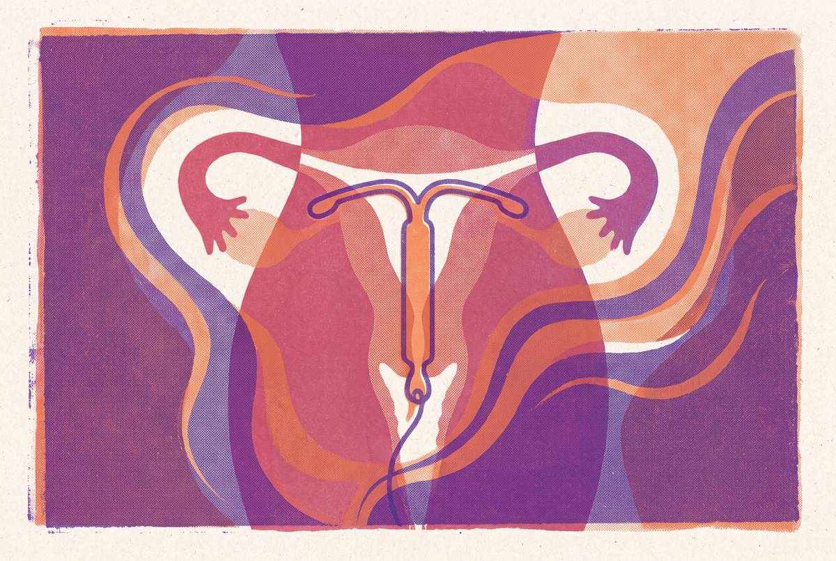 Cover illustration for “Mirena IUD Use During the Perimenopause Transition”
