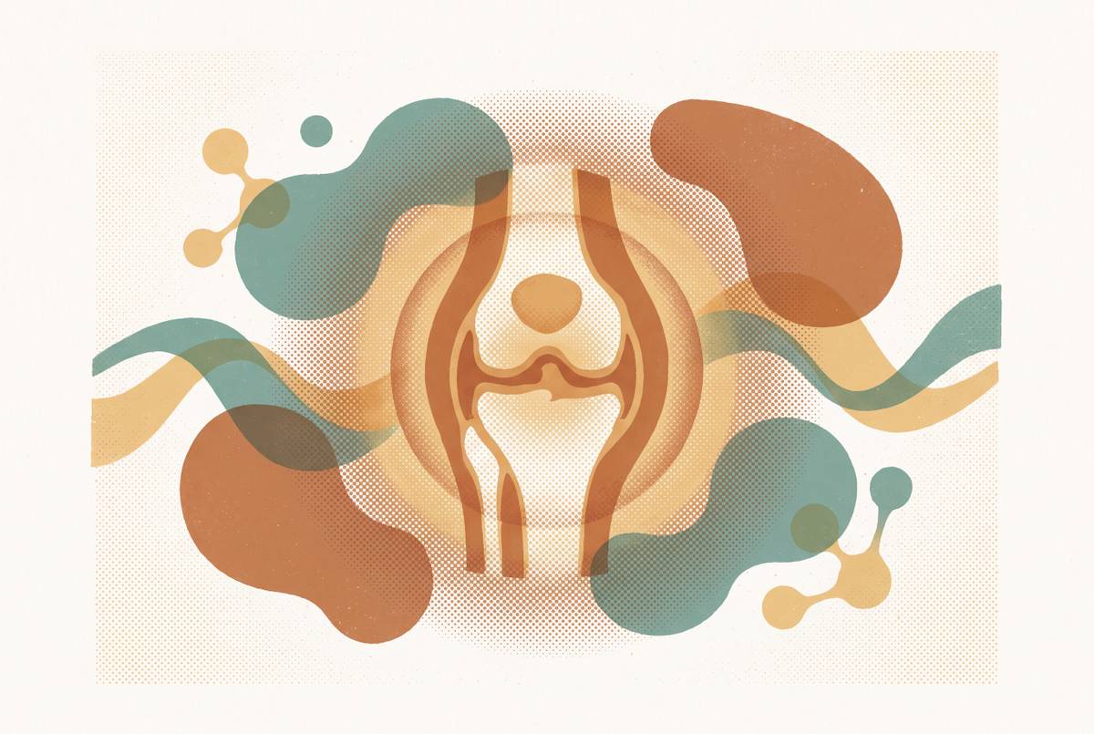 Cover illustration for “Joint Pain and Inflammation as Metabolic Symptoms in Perimenopause”