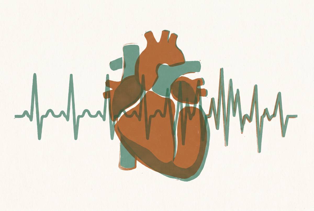Cover illustration for “Heart Palpitations in Perimenopause Versus Cardiac Causes”