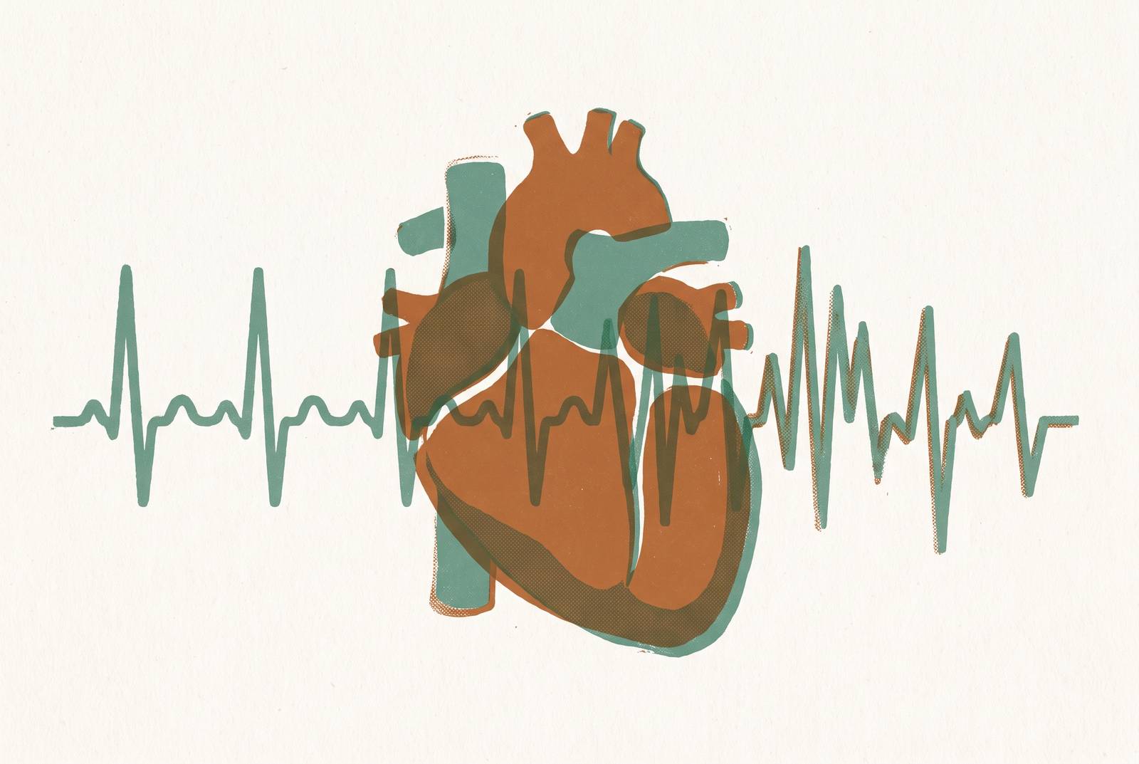 Cover illustration for “Heart Palpitations in Perimenopause Versus Cardiac Causes”